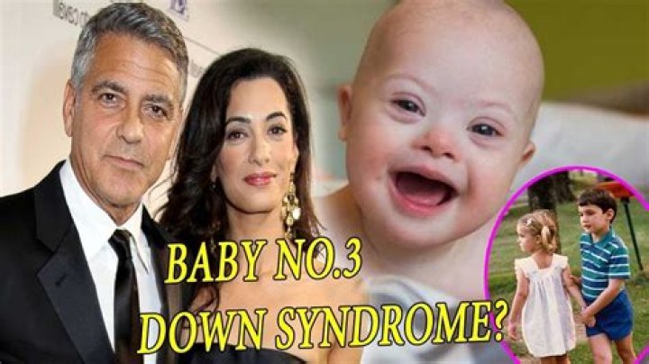 Exploring the Truth: George Clooney's Twins and Down Syndrome