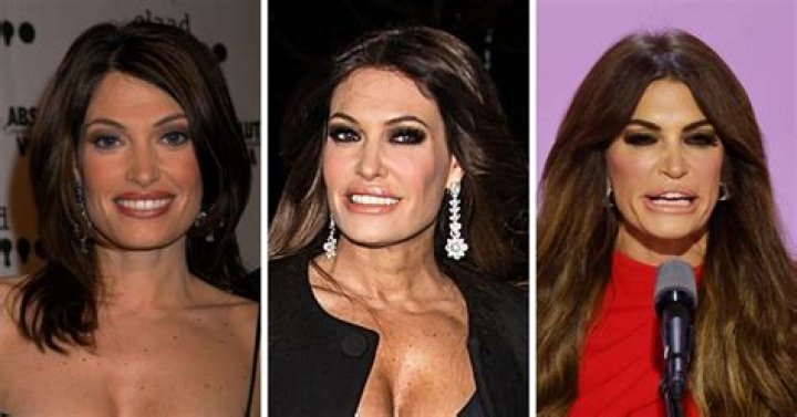 Kimberly Guilfoyle Plastic Surgery Photos: A Comprehensive Look
