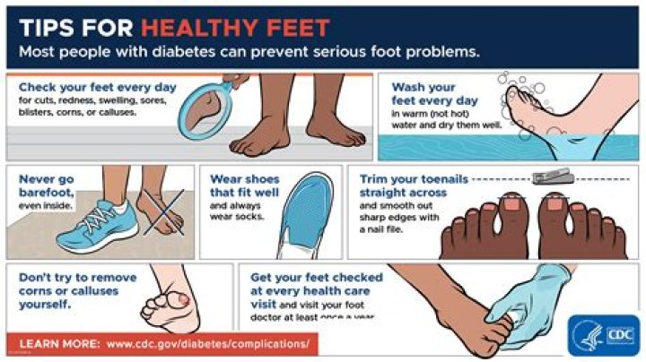 Rochelle Harrington Feet: A Comprehensive Guide to Foot Care and Health