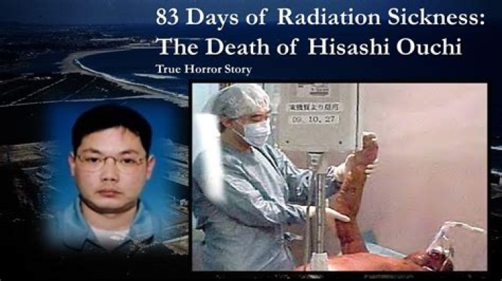The Tragic Story Behind Hisashi Ouchi Pictures: A Tale of Radiation and Resilience