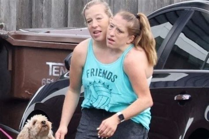 Tragic News: The Life and Legacy of Abby and Brittany Hensel